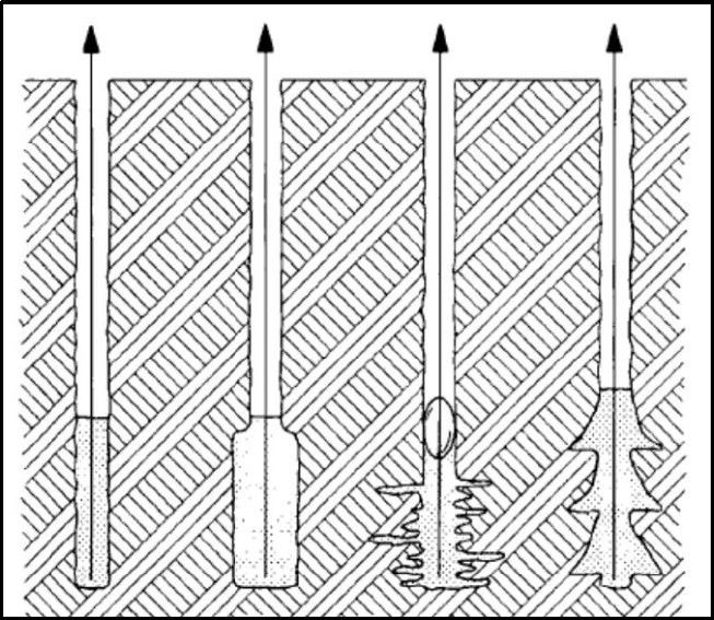 Sırasıyla enjeksiyon (grout) ankraj çeşitleri (A tip, B tip, C tip, D tip)